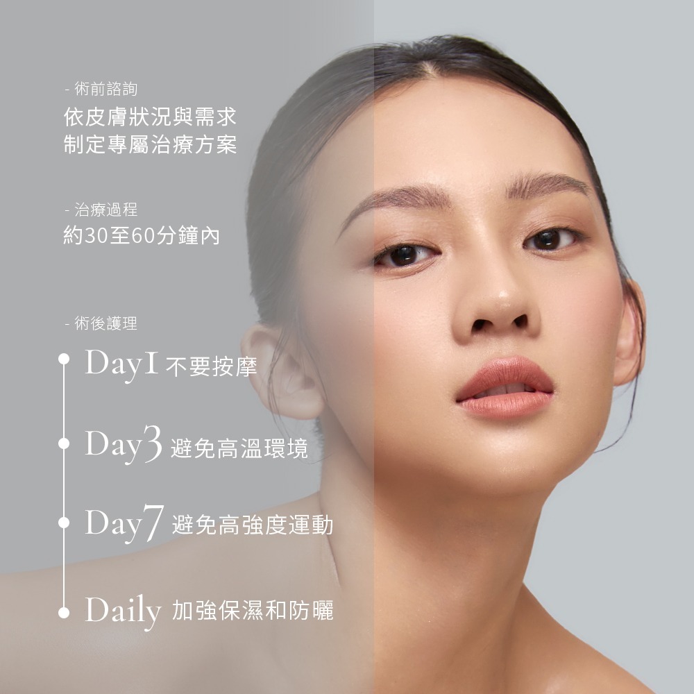 艾麗斯 AestheFill 治療流程和注意事項 艾麗斯 AestheFill 治療流程和注意事項 包含術前須知, 治療過程, 術後護理