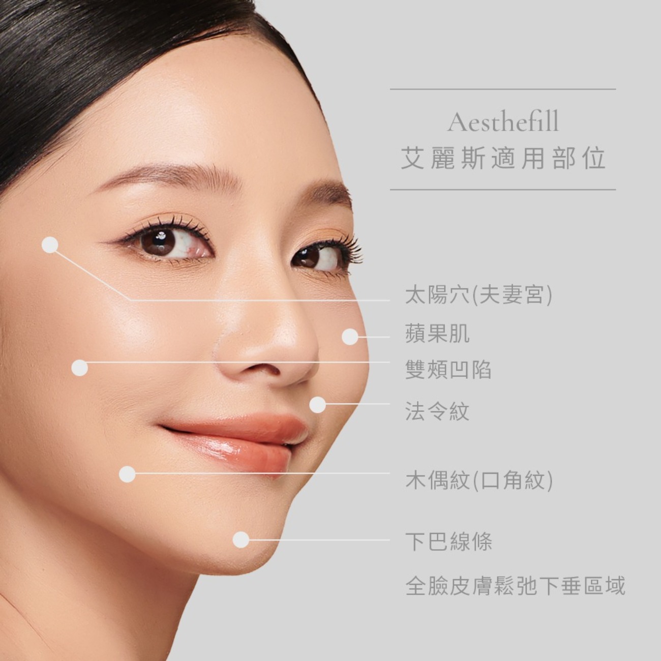 艾麗斯 AestheFill 適用部位 艾麗斯 AestheFill 適用部位 太陽穴(夫妻宮),蘋果肌,雙頰凹陷,法令紋,木偶紋(口角紋),下巴線條 ,全臉皮膚鬆弛下垂區域