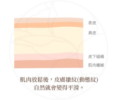 肉毒桿菌作用機制 肌肉放鬆後,皮膚皺紋(動態紋)自然就會變得平滑。
