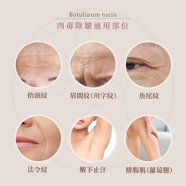 肉毒適用部位 肉毒適用部位,抬頭紋, 眉間紋, 魚尾紋, 法令紋, 腋下止汗, 蘿蔔腿