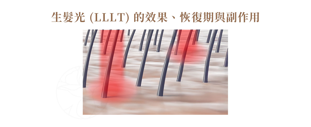 1. 生髮光效果：生髮光的效果因人而異，通常需要持續且規律的治療才能看到明顯改善。 大部分使用者在 3-6 個月後，能感覺到落髮量減少、頭髮變得更強韌2. 生髮光恢復期：生髮光是完全非侵入性的療程，因此沒有任何恢復期。 3. 生髮光（LLLT）可能的副作用：據現有研究與臨床經驗，生髮光被認為是相當安全的治療方式，且幾乎沒有副作用。 極少數人在治療初期可能會感到頭皮溫熱或輕微刺癢，但這些感覺通常是暫時性的很快就會消退。