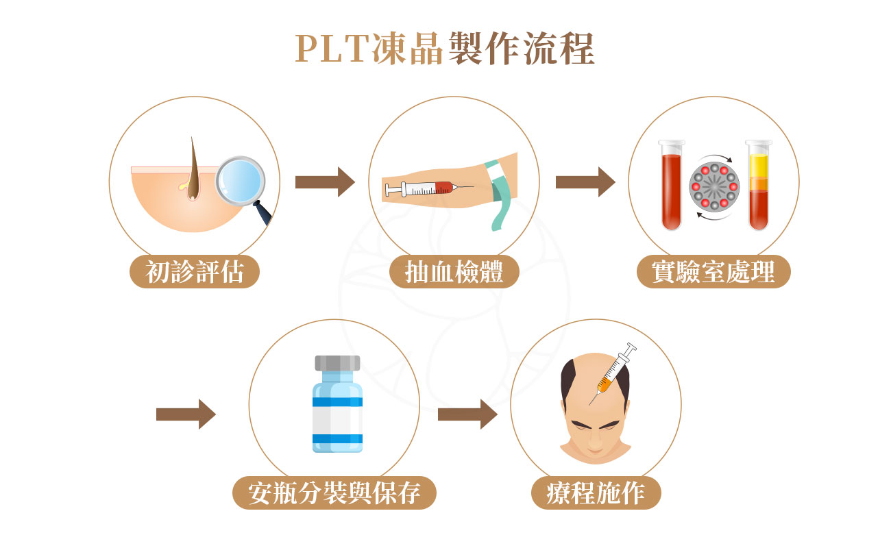 1. 初診評估：醫師進行頭皮檢測與毛囊狀態，確認是否適合 PLT 生髮。2. 抽血檢體：從手臂抽取自體血液。3. 實驗室處理：將血液送往符合 GMP 等級的實驗室。經專利純化程序，萃取血小板中的生長因子。4. 安瓶分裝與保存：處理完成的 PLT 凍晶分裝於無菌安瓶中。5. 療程施作：醫師依個人毛囊狀態，將 PLT 凍晶還原後注射至頭皮需要加強的部位。