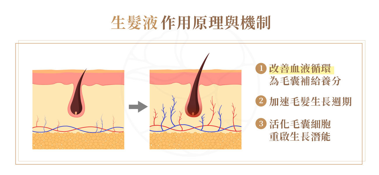 1. 改善血液循環，為毛囊補給養分：生髮液能擴張頭皮下的微血管，增加血液流量。2. 加速毛髮生長週期：生髮液能有效縮短毛囊的休止期，讓原本處於休息狀態的毛囊更快進入下一個生長期。3. 活化毛囊細胞，重啟生長潛能：生髮液能直接作用於毛囊細胞，刺激毛囊幹細胞與角質形成細胞的活性，喚醒毛囊的生長潛能。