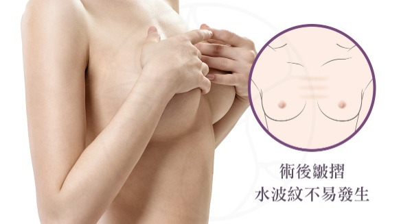 不易產生水波紋