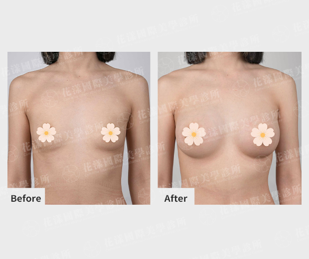 ALL_catalog_plasticsurgery_25L30_115OcjbeW3