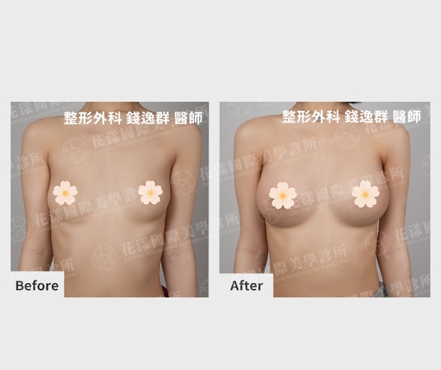 ALL_catalog_plasticsurgery_25L30_KfYOLqo1MH