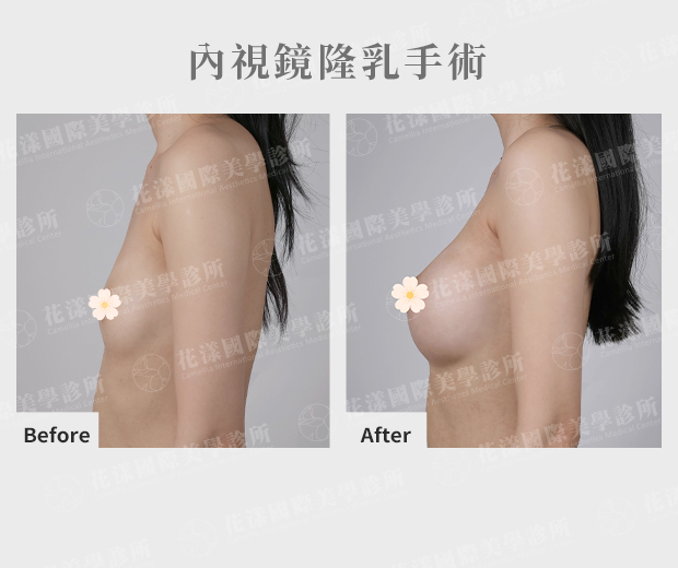 ALL_catalog_plasticsurgery_25L30_cXibYVzBWN