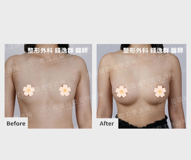 ALL_catalog_plasticsurgery_25L30_hU3iBQC2uK