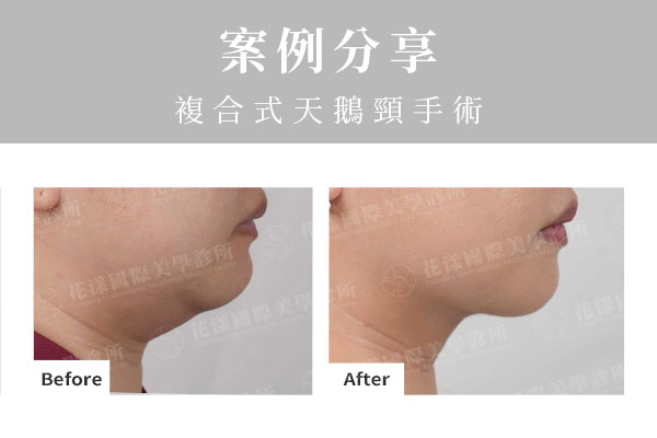 ALL_catalog_plasticsurgery_25L30_iuPDIaY8HB