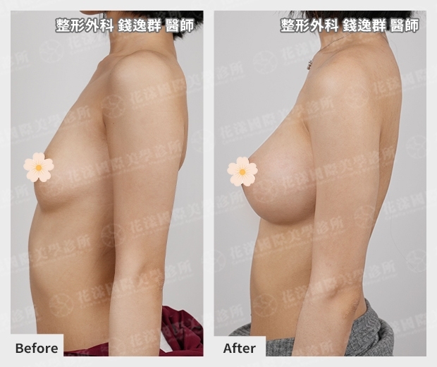 ALL_catalog_plasticsurgery_25L30_kYdfDTOVqg