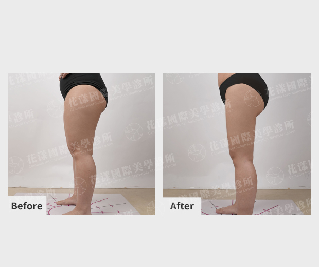 ALL_catalog_plasticsurgery_25L31_KO5E9SMMO0