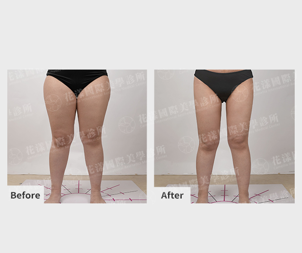 ALL_catalog_plasticsurgery_25L31_xgij6JjGnH