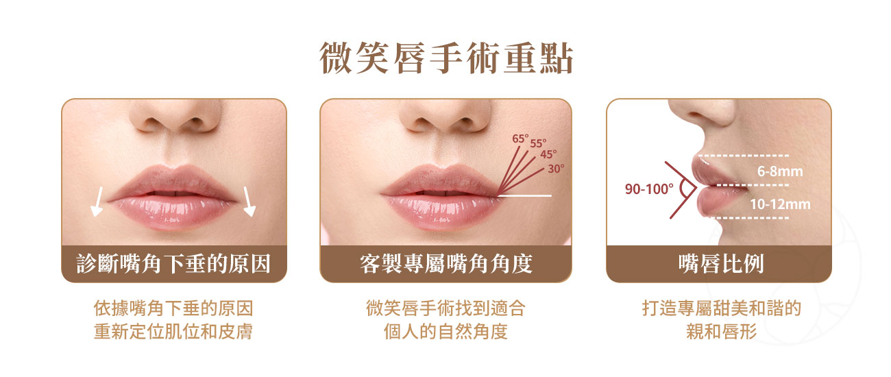 微笑唇手術重點:1.診斷嘴角下垂原因2.客製專屬嘴角角度3.打造最適嘴唇比例