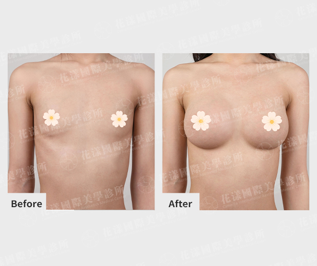 ALL_catalog_plasticsurgery_26A27_fKVzOEa55T