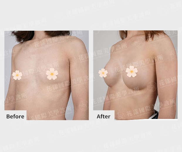 ALL_catalog_plasticsurgery_26A27_kNUPY8iW0z