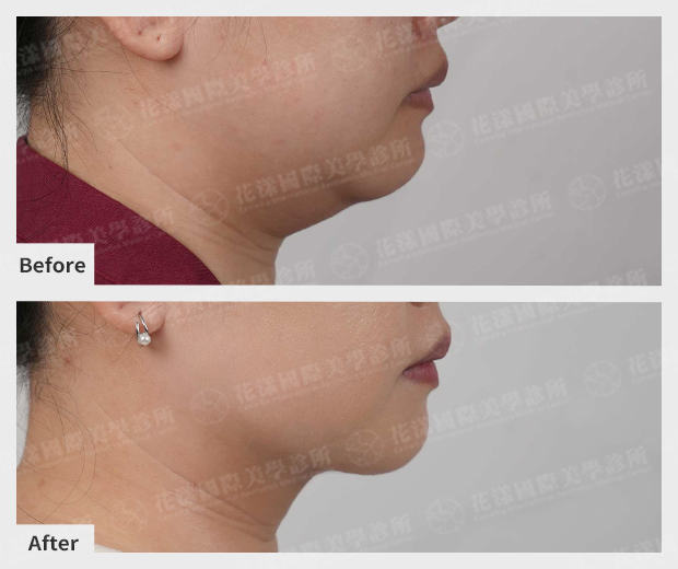 ALL_catalog_plasticsurgery_26B13_icRFYOUuk2