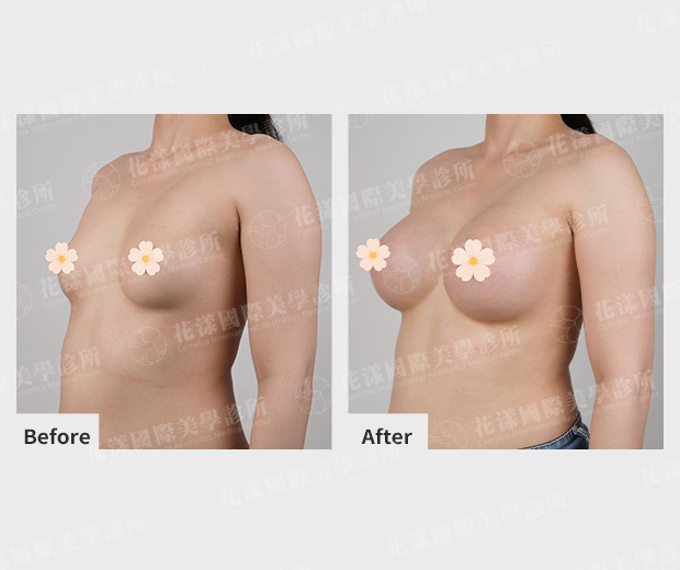 ALL_catalog_plasticsurgery_26D07_4lFpusSeZK