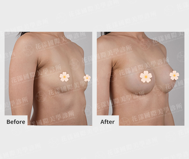 ALL_catalog_plasticsurgery_26D07_Eevuxqhomf