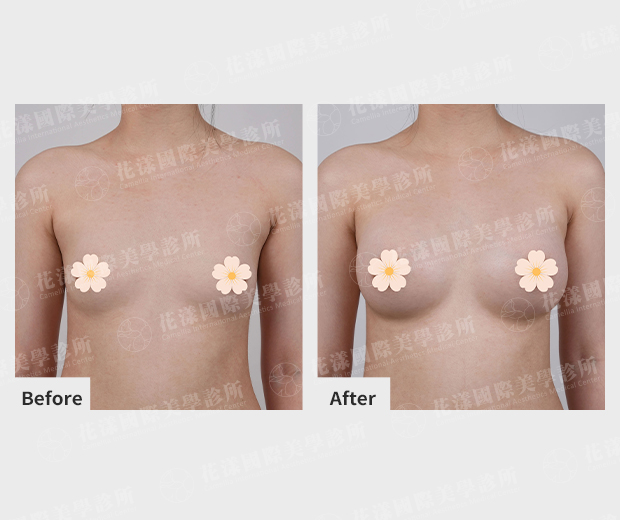 ALL_catalog_plasticsurgery_26D07_KmSZSACvaB