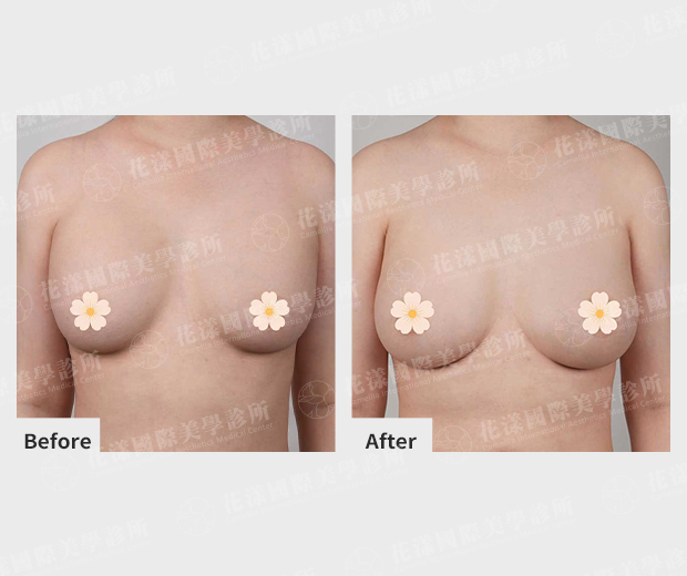 ALL_catalog_plasticsurgery_26D08_DGMMeTEMcB