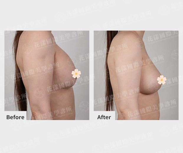 ALL_catalog_plasticsurgery_26D08_Y6af93ilHk
