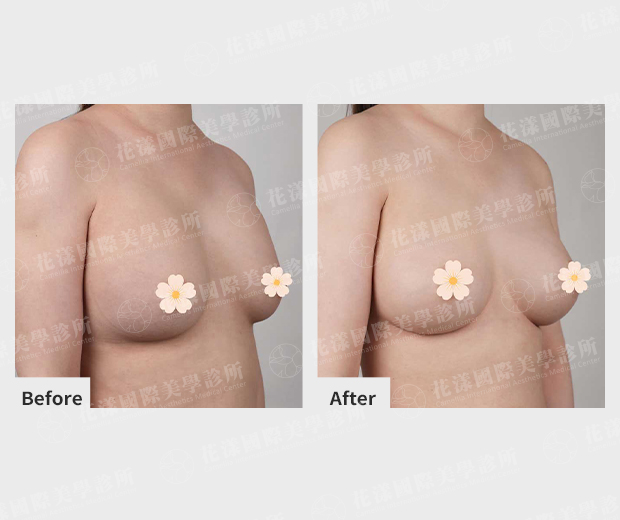 ALL_catalog_plasticsurgery_26D08_YJ40ohfW1P