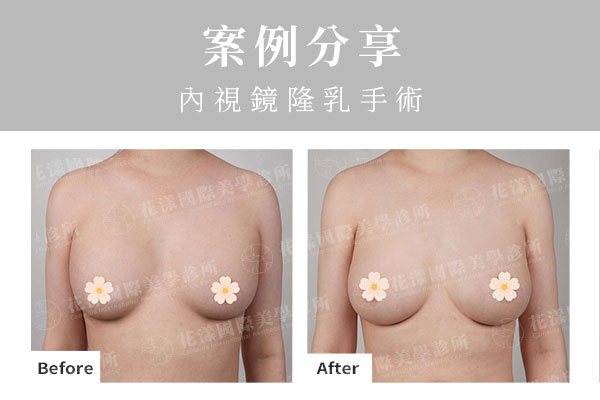 ALL_catalog_plasticsurgery_26D08_tphYnRNEzw