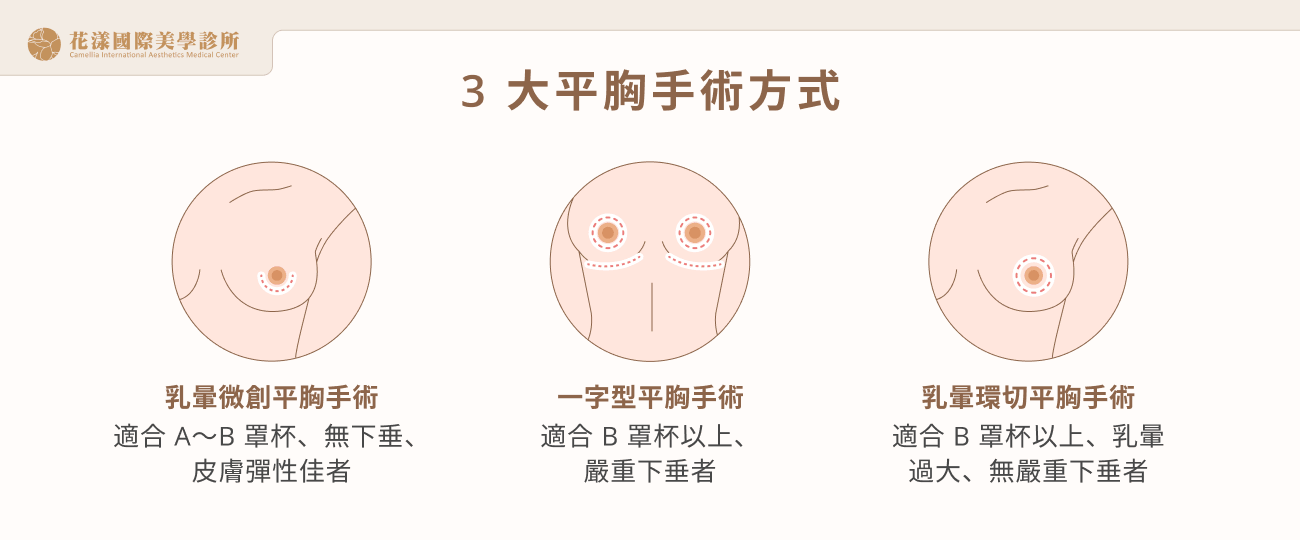 ALL_catalog_plasticsurgery_26F08_oVGsxc0L0L 3 大平胸手術方式