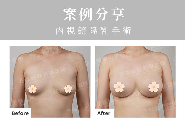 ALL_catalog_plasticsurgery_26G10_jkFZ9y7oY5