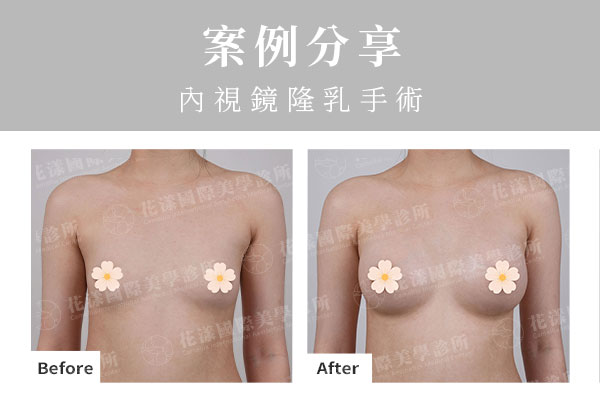 ALL_catalog_plasticsurgery_26G10_kx9u1REs45