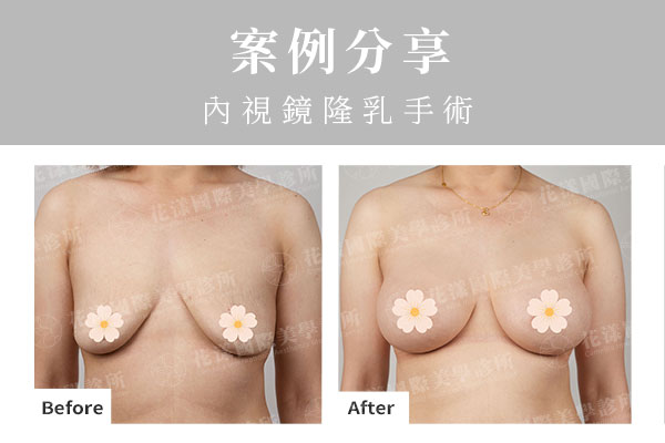 ALL_catalog_plasticsurgery_26G10_dW7y0ZR9bS