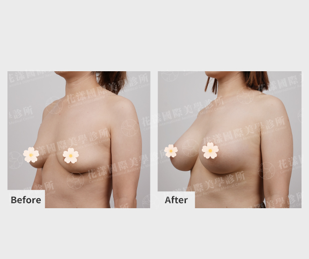 ALL_catalog_plasticsurgery_26G31_7nSXh75RM5