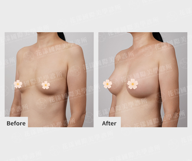 ALL_catalog_plasticsurgery_26G31_Pc1ucikTHn