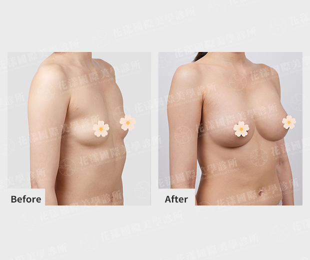 ALL_catalog_plasticsurgery_26G31_aRG8yLAqJP