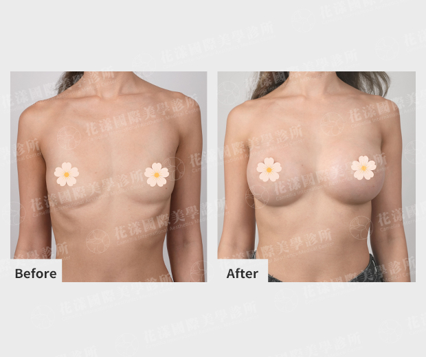ALL_catalog_plasticsurgery_26G31_brAWrnZwz8