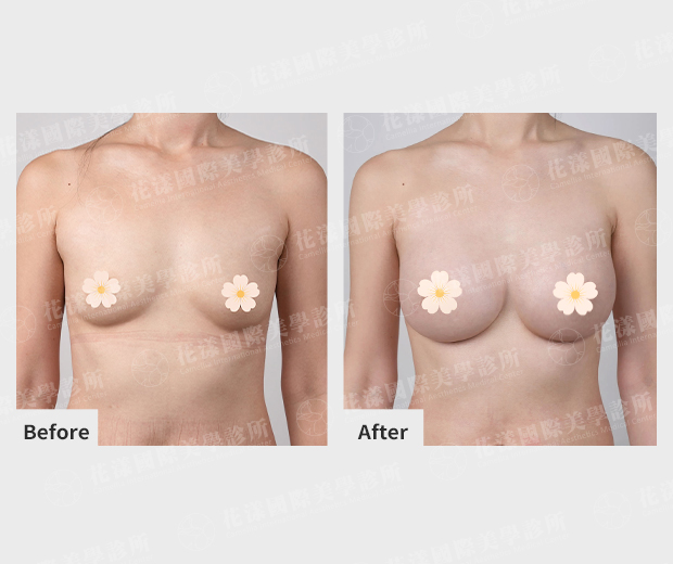ALL_catalog_plasticsurgery_26G31_jGjwcsAvBt