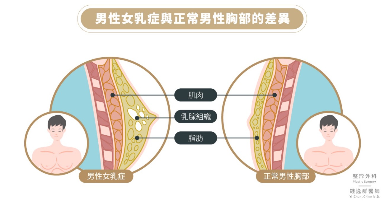 twL_catalog_plasticsurgery_24F13_CSRf866QNv