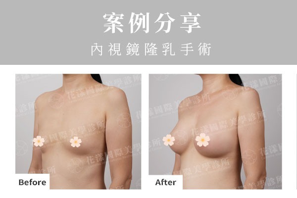 twL_catalog_plasticsurgery_25J07_CEh5OXm8EZ