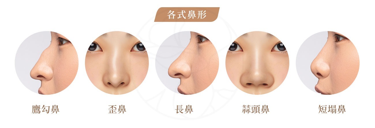 結構式隆鼻適合什麼人？朝天鼻、歪鼻、蒜頭鼻、短鼻、鷹勾鼻等