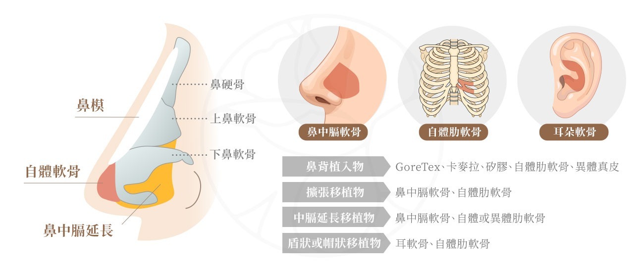 結構式隆鼻的鼻樑重建，自體材料中選擇有鼻中膈軟骨、自體肋軟骨、耳朵軟骨。人工材料（Alloplastic implants）  包括二代矽膠、Gore-Tex（膨體聚四氟乙烯）、卡麥拉（矽膠核心外包 Gore-Tex 的複合材質）等。
