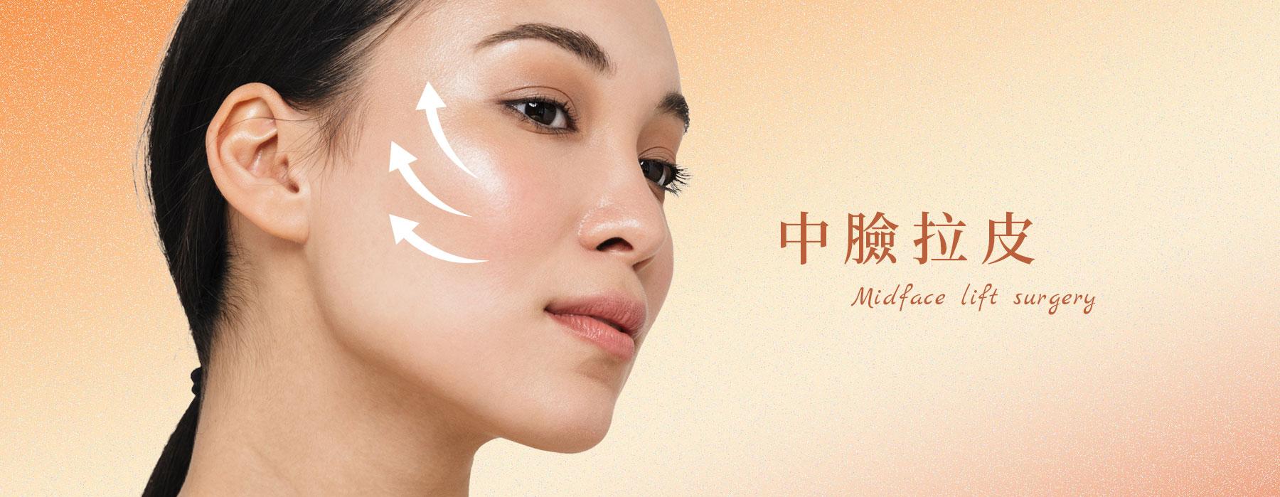 內視鏡中臉拉皮手術｜隱痕微笑拉提