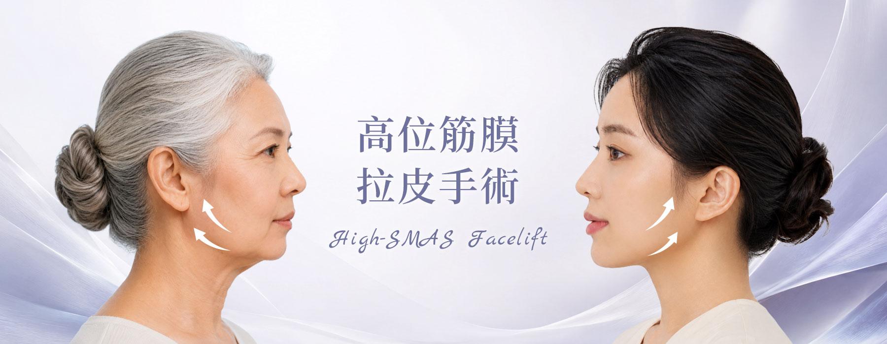 高位筋膜拉皮