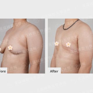 ALL_catalog_plasticsurgery_25I19_CdCExiHEsm