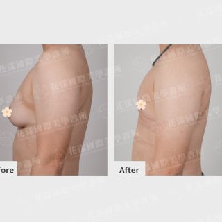 ALL_catalog_plasticsurgery_25I19_ESGfeQJTmn