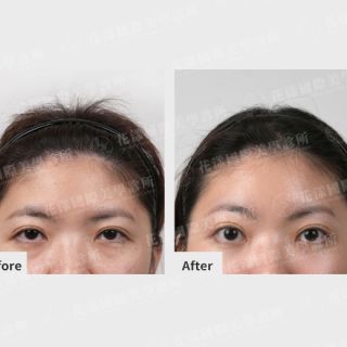 ALL_catalog_plasticsurgery_25J13_GYtCd9oQPu