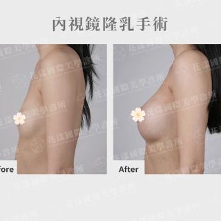 ALL_catalog_plasticsurgery_25L30_Cy8AWW0nd8