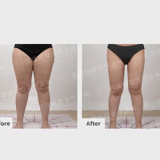 ALL_catalog_plasticsurgery_25L30_PJYdk8H0EJ