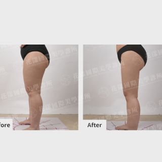 ALL_catalog_plasticsurgery_25L30_afyJ4ZuLer