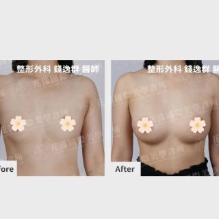 ALL_catalog_plasticsurgery_25L30_hU3iBQC2uK