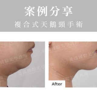 ALL_catalog_plasticsurgery_25L30_iuPDIaY8HB